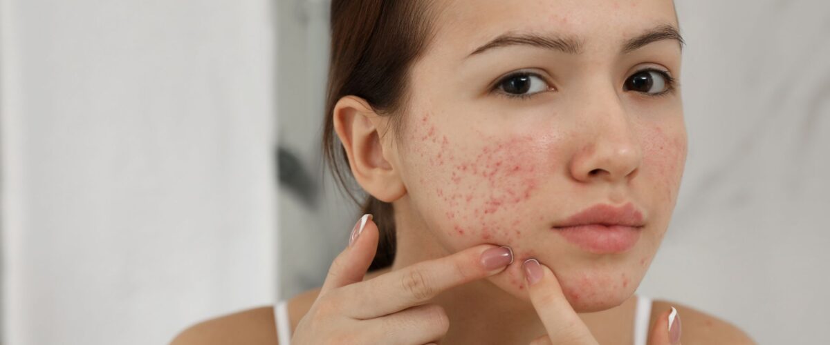 سلول درمانی