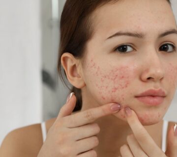 سلول درمانی